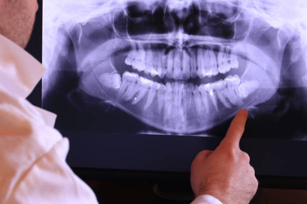Best Emergency Broken Tooth Repair in Irvine, CA